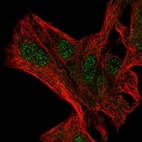 Anti-NFXL1 Antibody