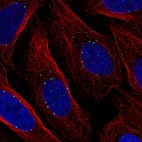 Immunofluorescent staining of human cell line U-2 OS shows localization to vesicles.