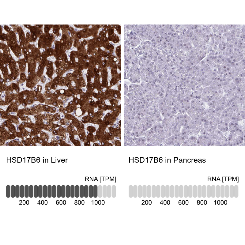 Anti-HSD17B6 Antibody