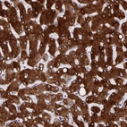 Immunohistochemical staining of human liver shows strong cytoplasmic positivity in hepatocytes.
