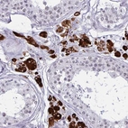 Immunohistochemical staining of human testis shows strong cytoplasmic positivity in Leydig cells.