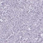 Immunohistochemical staining of human pancreas shows no positivity as expected.