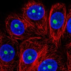 Anti-SNRNP35 Antibody