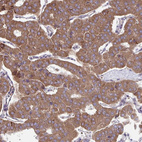 Anti-ITPR2 Antibody