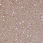 Anti-CLTC Antibody