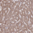 Immunohistochemical staining of human liver shows moderate cytoplasmic and membranous positivity in hepatocytes.