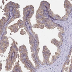 Immunohistochemical staining of human prostate shows moderate granular cytoplasmic positivity in glandular cells.