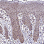 Anti-ITPR2 Antibody