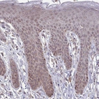 Immunohistochemical staining of human skin shows weak cytoplasmic positivity in squamous epithelial cells.