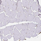 Immunohistochemical staining of human skeletal muscle shows low positivity in myocytes as expected.