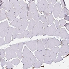 Immunohistochemical staining of human skeletal muscle shows low positivity in myocytes as expected.