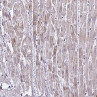 Anti-BCL6B Antibody