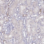 Anti-KCNK5 Antibody