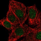 Immunofluorescent staining of human cell line MCF7 shows localization to nucleus.