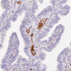 Anti-ITIH2 Antibody