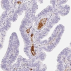 Immunohistochemical staining of human fallopian tube shows strong positivity in plasma in blood vessels.