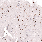 Anti-BCL11A Antibody