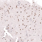 Immunohistochemical staining of human cerebral cortex shows strong nuclear positivity in neurons.