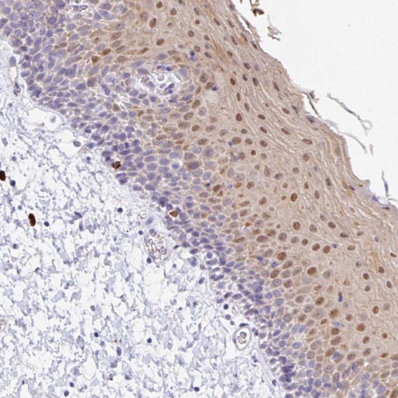 Anti-ZNF684 Antibody