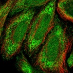 Immunofluorescent staining of human cell line SiHa shows localization to nucleus & cytosol.