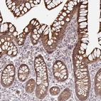 Immunohistochemical staining of human small intestine shows strong granular cytoplasmic positivity in glandular cells.
