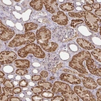 Immunohistochemical staining of human kidney shows strong granular cytoplasmic positivity in cells in tubules.