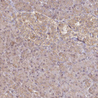 Anti-CYP27A1 Antibody