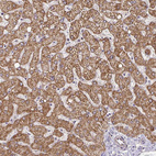 Anti-CYP27A1 Antibody