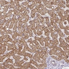 Immunohistochemical staining of human liver shows strong granular cytoplasmic positivity in hepatocytes.