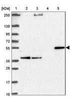 Lane 1: Marker [kDa] 250, 130, 95, 72, 55, 36, 28, 17, 10_br/_Lane 2: Human cell line RT-4_br/_Lane 3: Human cell line U-251MG sp_br/_Lane 4: Human plasma (IgG/HSA depleted)_br/_Lane 5: Human liver tissue