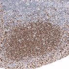 Immunohistochemical staining of human tonsil shows strong nuclear positivity in germinal center cells.