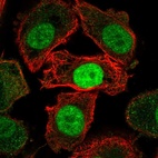 Anti-JMJD6 Antibody