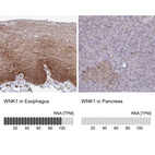 Anti-WNK1 Antibody