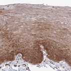 Immunohistochemical staining of human esophagus shows high expression.