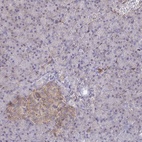 Anti-WNK1 Antibody