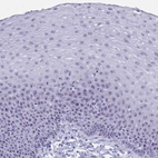 Anti-TBC1D29 Antibody