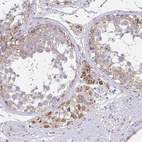 Anti-TMEM219 Antibody