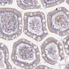 Immunohistochemical staining of human small intestine shows moderate positivity in glandular cells.