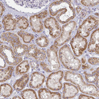 Immunohistochemical staining of human kidney shows moderate positivity in cells in tubules.