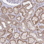 Immunohistochemical staining of human kidney shows moderate positivity in cells in tubules.
