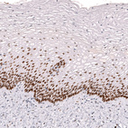 Anti-BCL11A Antibody