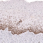 Immunohistochemical staining of human cervix shows strong nuclear positivity in squamous epithelial cells.