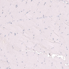 Immunohistochemical staining of human skeletal muscle shows no positivity in myocytes as expected.