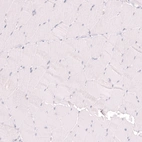 Immunohistochemical staining of human skeletal muscle shows no positivity in myocytes as expected.