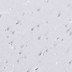 Anti-NOP10 Antibody