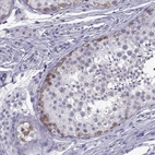 Immunohistochemical staining of human testis shows high expression.