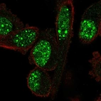 Immunofluorescent staining of human cell line PC-3 shows localization to nuclear bodies.