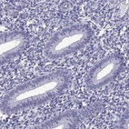 Immunohistochemical staining of human endometrium shows low expression as expected.