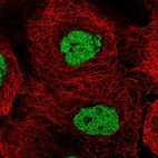 Anti-CSNK2A1 Antibody