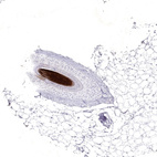 Anti-KRTAP2-4 Antibody